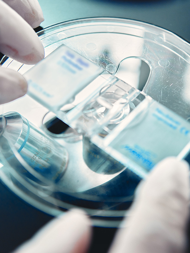 Close up of hemocytometer counting chamber